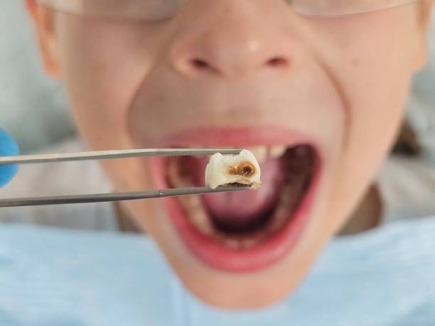 Best Tooth Pain Emergency Relief  in Fisher, IL